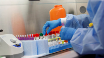 A medical technologist tests a respiratory panel at Northwell Health Labs, where the same test will be used on the COVID-19