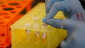 A Lab technician works at Sorrento Therapeutics where efforts are underway to develop an antibody, STI-1499, to help in prevention of the coronavirus disease (COVID-19) in San Diego