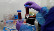 Blood samples from patients infected with the coronavirus disease (COVID-19) are prepared for analysis as part of the TACTIC-R trial, in the Blood Processing Lab