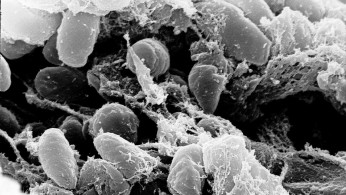BLACK DEATH