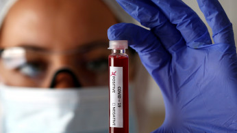FILE PHOTO: Fake blood is seen in test tubes labelled with the coronavirus (COVID-19) in this illustration taken March 17, 2020.