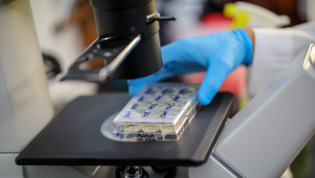 FILE PHOTO: A scientist holds cells that produce antibodies