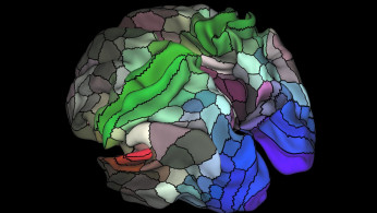 Alzheimer's 