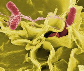 INFECTION