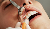 dentist, teeth