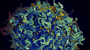 HIV