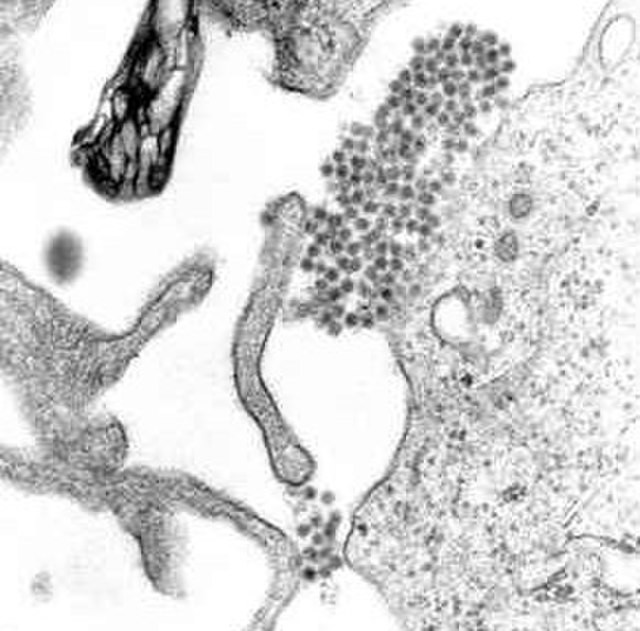 Health Emergency Declared in Rio Amid Rising Dengue Fever Cases