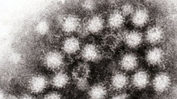 Migrants Blamed for Norovirus Outbreak in Northeast by 'Outraged' Social Media Users, What Does CDC Data Say?