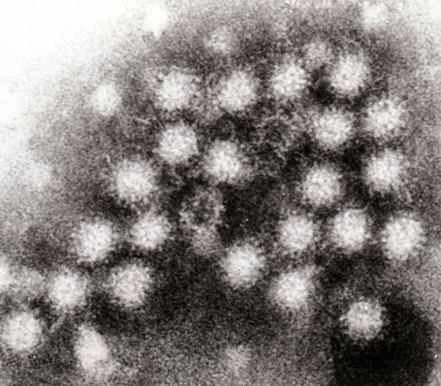 Migrants Blamed for Norovirus Outbreak in Northeast by 'Outraged' Social Media Users, What Does CDC Data Say?