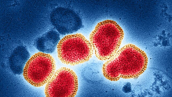 Second U.S. Human Case of Bird Flu Linked to Dairy Cows Confirmed in Michigan