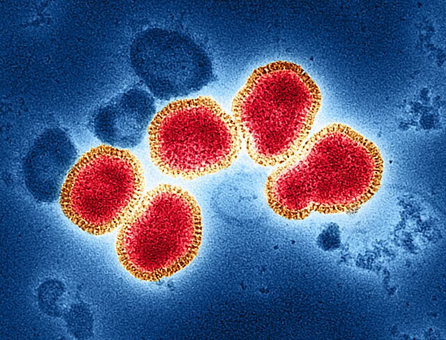 Second U.S. Human Case of Bird Flu Linked to Dairy Cows Confirmed in Michigan
