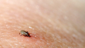 Maine Confirms First Fatal Case of Tick-Borne Powassan Virus in 2024