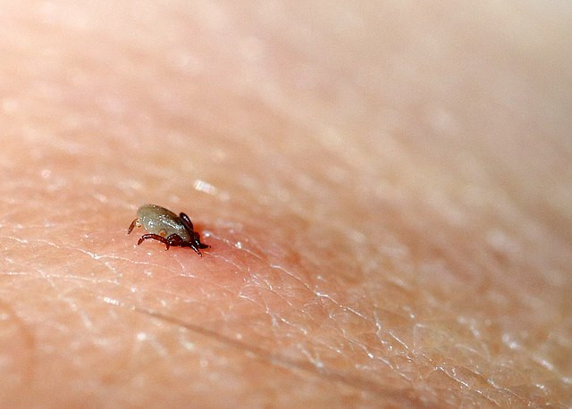 Maine Confirms First Fatal Case of Tick-Borne Powassan Virus in 2024