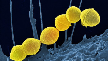 Japan Faces Surge in Fatal Bacterial Infection Amid Lingering Post-Pandemic Effects