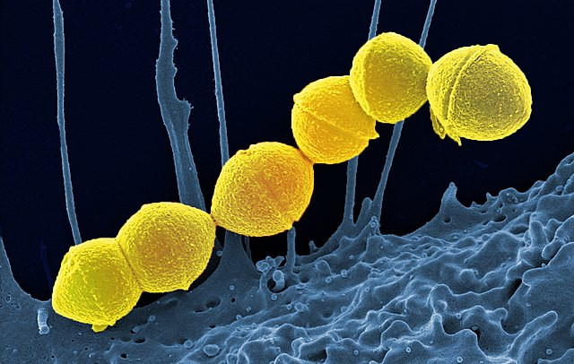 Japan Faces Surge in Fatal Bacterial Infection Amid Lingering Post-Pandemic Effects