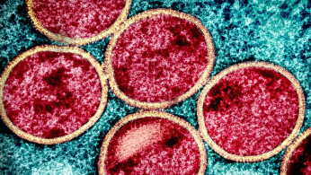 Dangerous New Mpox Strain Emerges in Congo, WHO Calls for Immediate Action