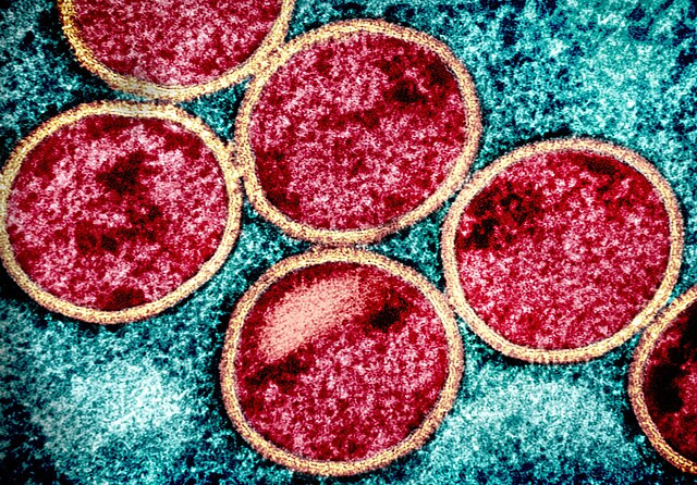 Dangerous New Mpox Strain Emerges in Congo, WHO Calls for Immediate Action