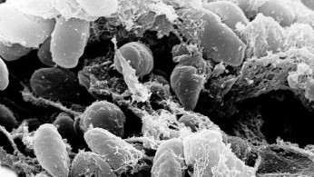  First Human Plague Case in Pueblo County Triggers Urgent Health Investigation