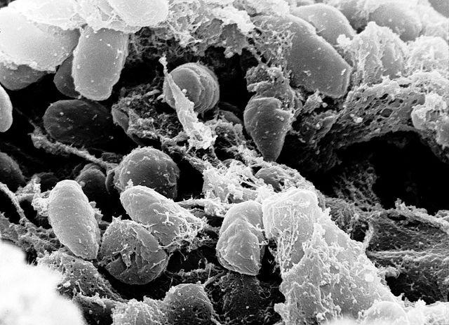  First Human Plague Case in Pueblo County Triggers Urgent Health Investigation