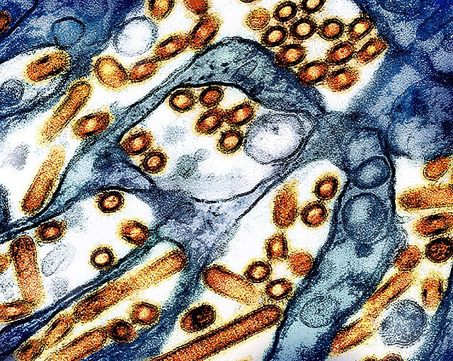 Bird Flu Cases Surge in Colorado: Human Infections Spark Concerns Amid Dairy and Poultry Outbreaks