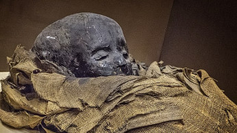 Egyptian 'Screaming Woman' Mummy Reveals Agonizing Death Through Advanced Scans, New Study Suggests