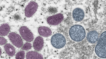 WHO Declares Global Health Emergency Over Escalating Mpox Outbreak in Africa