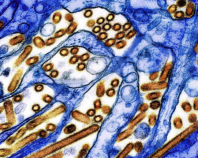 First U.S. Human Case of Bird Flu Without Animal Contact Raises Concerns Among Health Officials