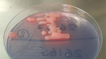 Superbugs Expected to Kill 39 Million by 2050, Global Study Warns