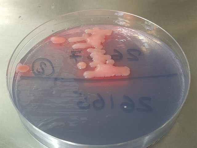 Superbugs Expected to Kill 39 Million by 2050, Global Study Warns