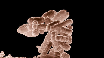 E. Coli Outbreak in St. Louis Spreads to Six States, Investigation Nears End