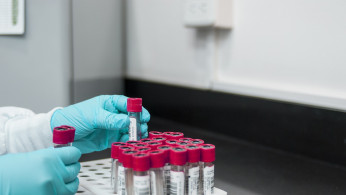 Study Reveals Lead Exposure Linked to 151 Million U.S. Psychiatric Cases Over 75 Years