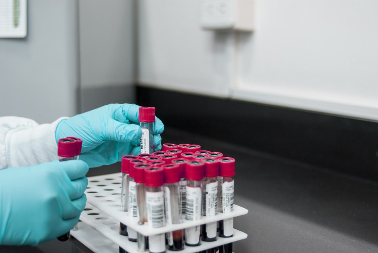 Study Reveals Lead Exposure Linked to 151 Million U.S. Psychiatric Cases Over 75 Years