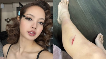 Blackpink Lisa’s ‘Born Again’ MV Photos Shock Fans, Visible Bloodstains on Leg Raise Concerns
