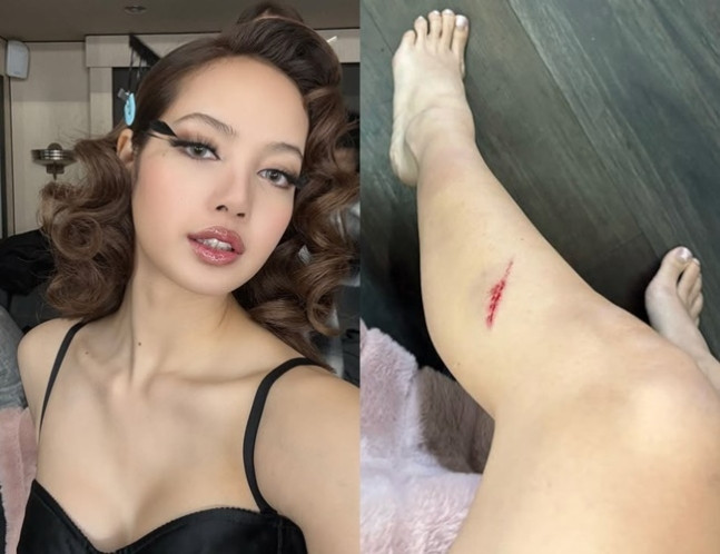Blackpink Lisa’s ‘Born Again’ MV Photos Shock Fans, Visible Bloodstains on Leg Raise Concerns