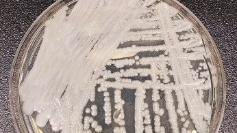 Deadly Fungus Candida Auris Spreading in U.S. Healthcare System, CDC Warns of 'Urgent Threat'
