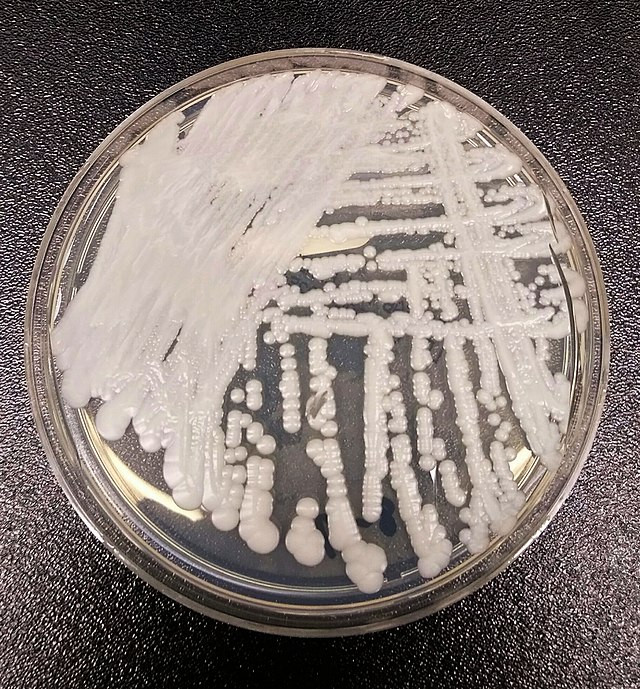 Deadly Fungus Candida Auris Spreading in U.S. Healthcare System, CDC Warns of 'Urgent Threat'