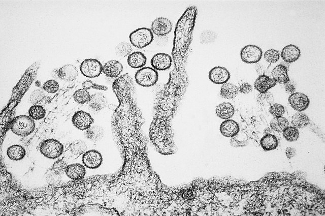 Rare Hantavirus Kills Third Person in California Town, Same Virus Linked to Gene Hackman’s Wife