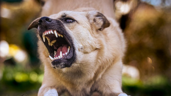 Georgia Boy, 11, Survives Three-Dog Mauling as Best Friend Stays Behind to Fight for Him