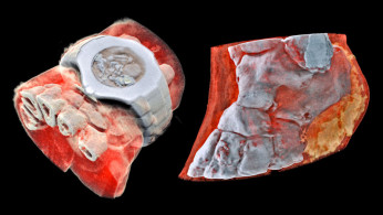 3D Colored X-Ray