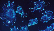 Cancer Cells