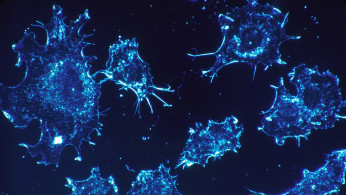 Cancer Cells