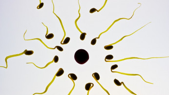 Sperm Cells