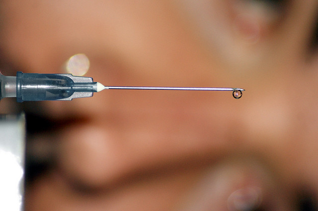 Botox injection