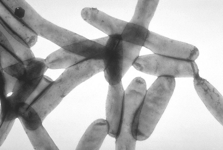 Legionnaires’ Disease