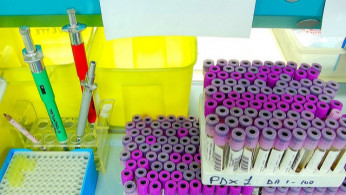 Test Tubes