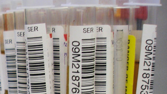 Blood Samples
