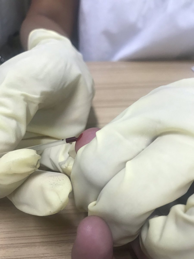 HIV testing