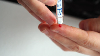 London Patient Might Be The Second Person Treated Of HIV